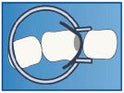 Ring with Flat Tines