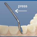 Matrices for Front Teeth Restoration (Large) 12pcs