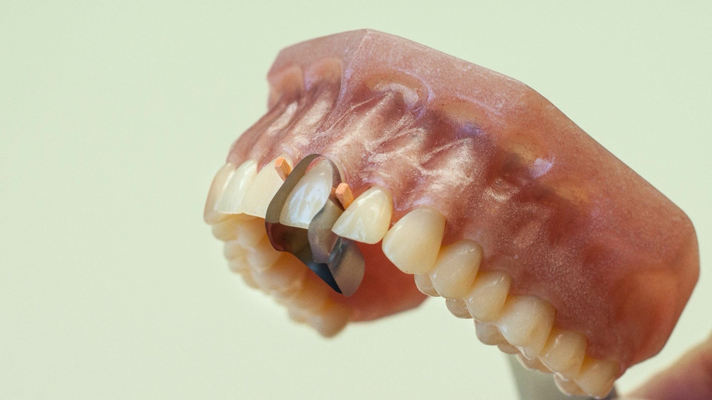 Twin Anterior Matrices (Palatal) 12pcs