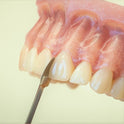 Matrices for Front Teeth Restoration (Medium) 12pcs