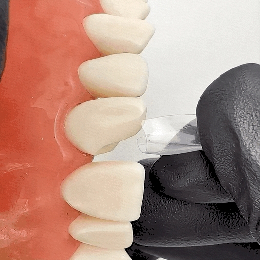 Bow Anterior Matrices 10pcs medical equipment for hospital and laboratory use