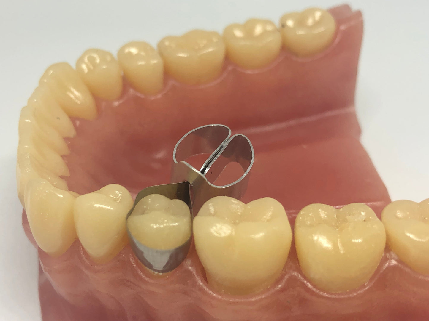 Metal Contoured Matrices for Molars Combined with Clamp 10pcs
