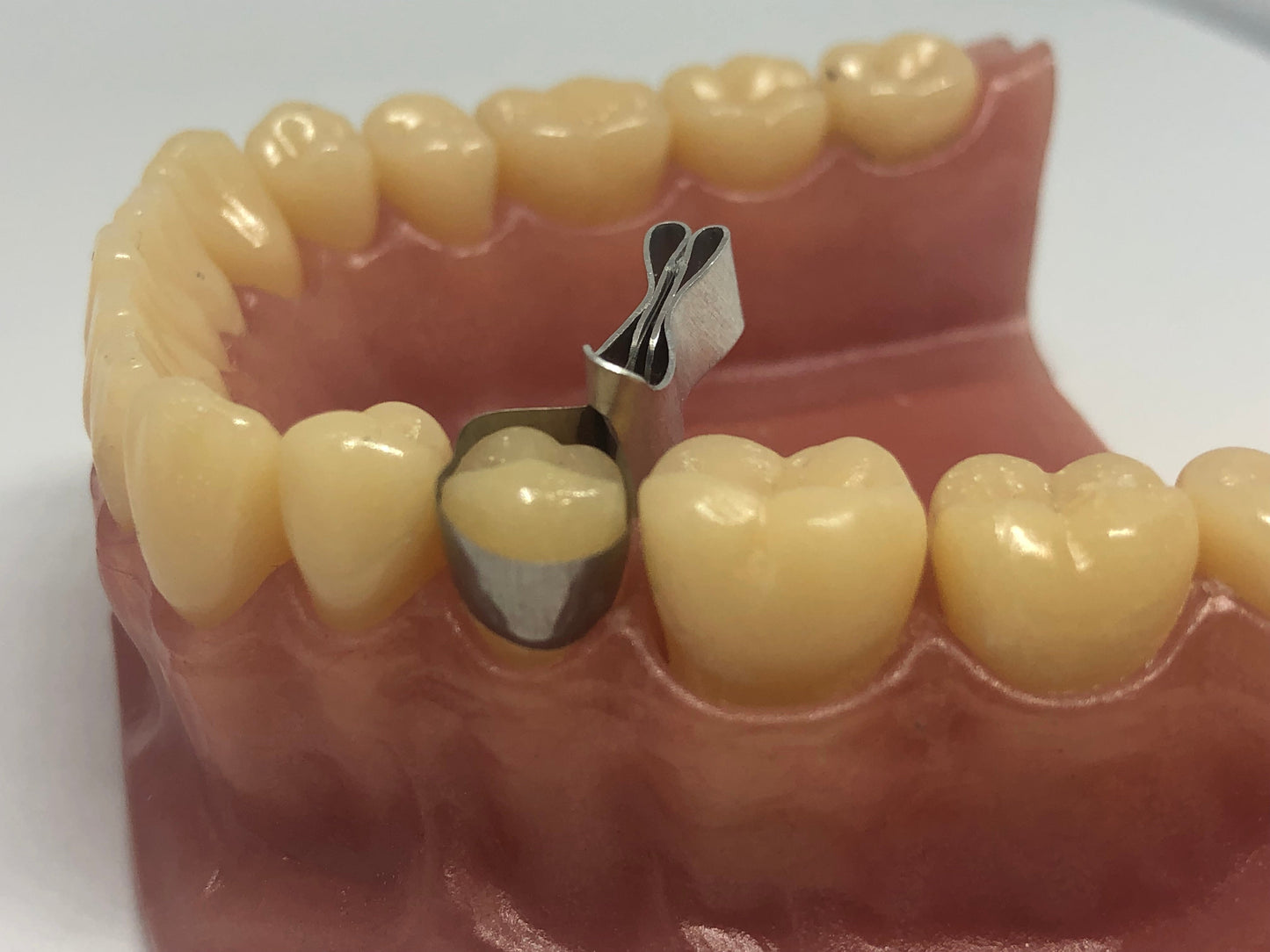 Metal Contoured Matrices for Molars Combined with Clamp 10pcs