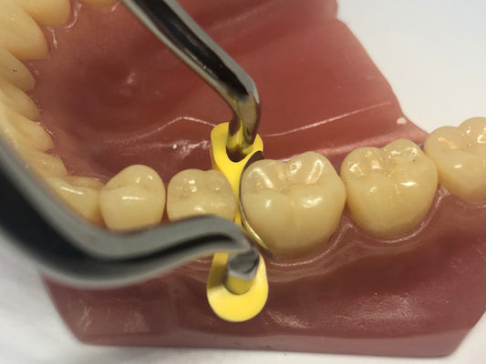 "Elastic" Fixing Wedges Soft 10pcs