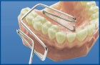 Retractor (with Handle)