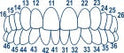 Anterior Transparent Crowns 64pcs
