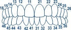 Anterior Transparent Crowns 64pcs