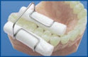 Cotton Roll Holder